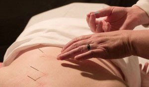 New Freedom Acupuncture